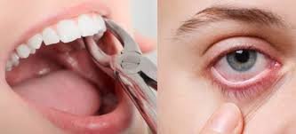 Relation between eye and toothache #best dental clinic for teeth whitening near me
#affordable dental treatment in dhaka city
#emergency tooth pain relief near me
#invisible braces cost and treatment
#painless root canal treatment
#family dental clinic near me
#cosmetic dentistry before and after
#senior citizen dental care